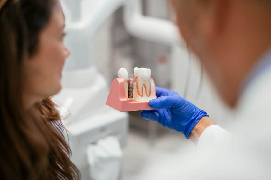 4 Myths About Dental Implants