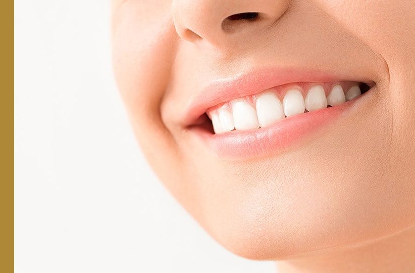 Cosmetic Periodontal Surgery